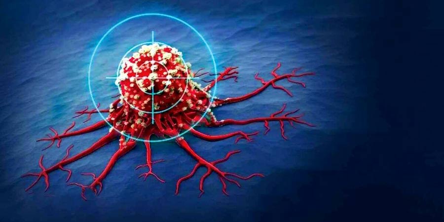 درمان سرطان سینه